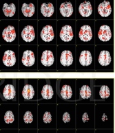 This is your brain on pain