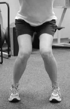 Valgus Collapse Valgus Collapse